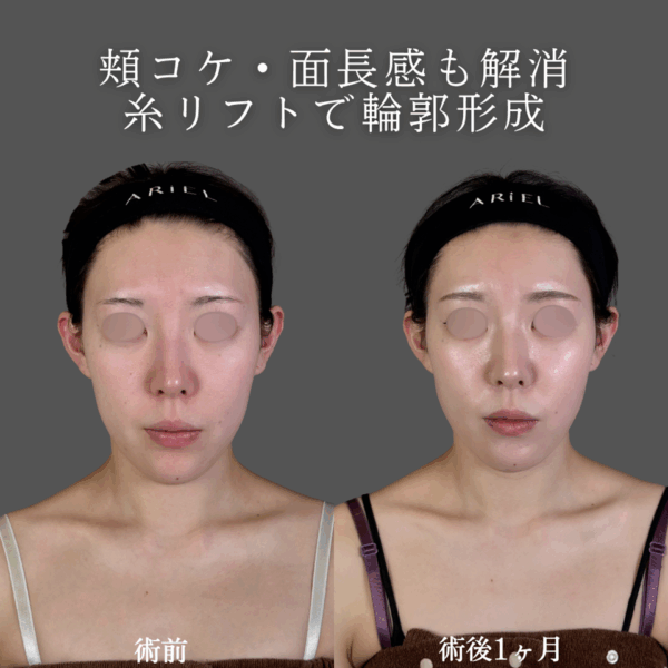 No.8866の症例写真
